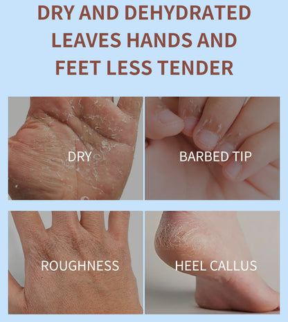 Comparison of dry, barbed tip, roughness, and heel callus on hands and feet with text about skin conditions. Estelin coconut oil hand cream 